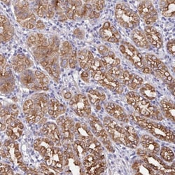 ZIK1 Antibody, Novus Biologicals 0.1mL; Unlabeled:Antibodies, Polyclonal